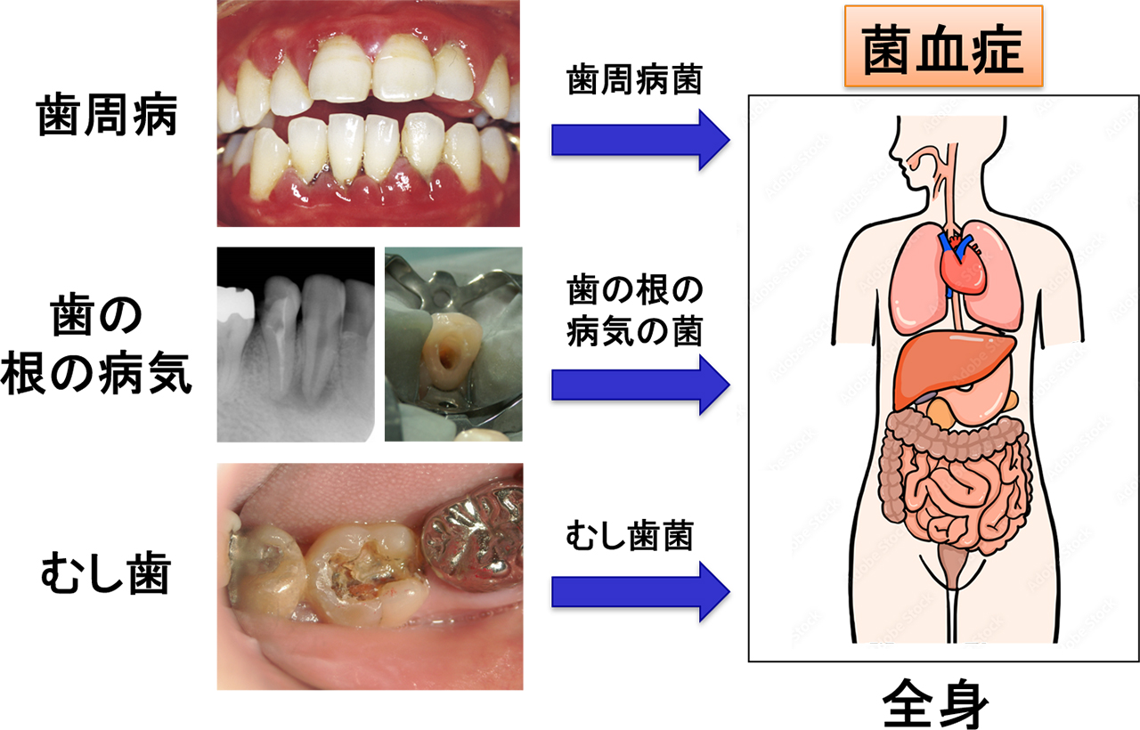 医科歯科連携による総合的治療